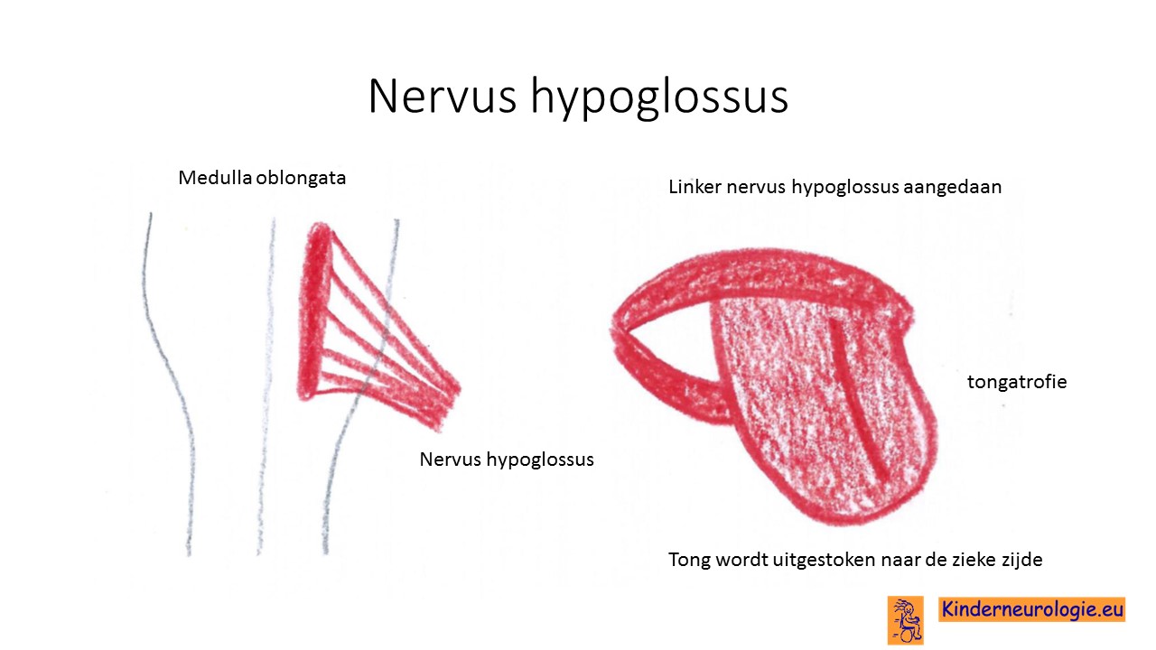 Nervus Hypoglossus (Hipoglossal Sinir) • Doktordan Haberler